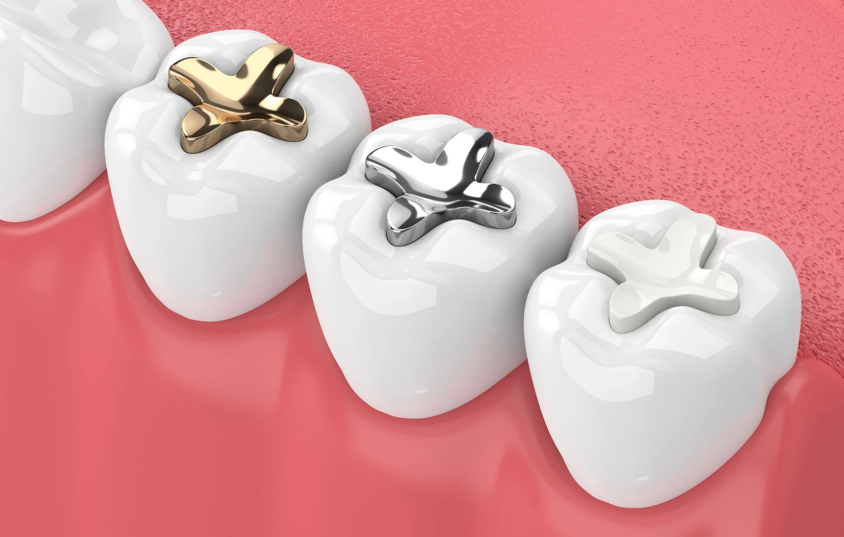 Nagy & Majestro DDS Nagy & Majestro DDS
